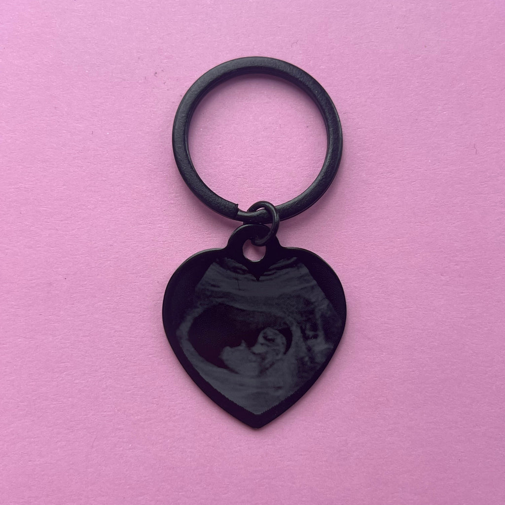 Personalised Ultrasound Keychain